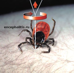 Извлечение Клеща